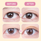 ✨Last Day Buy 1 Get 1 Free✨Invisible Strong Support Double Eyelid Tapes for Enlarging Eyes