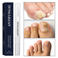 Toenail Fungus Treatment Pen for Damaged Nails